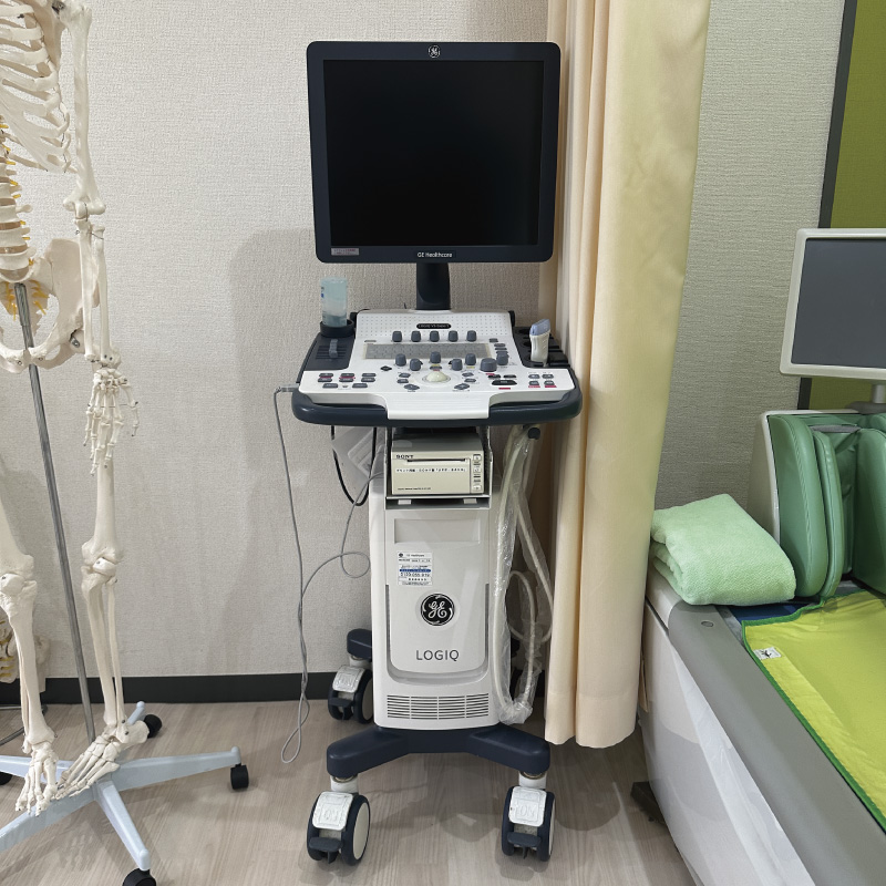 超音波診断装置(エコー)